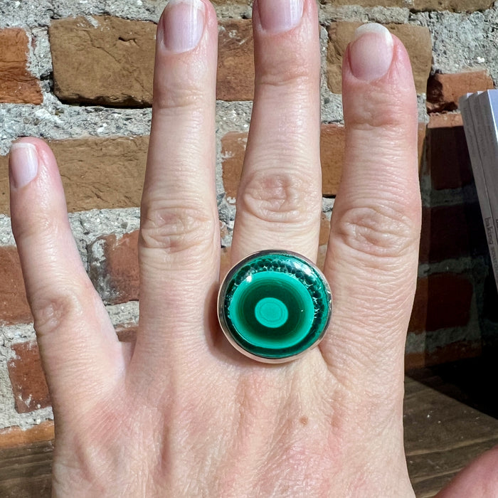Malachite Ring
